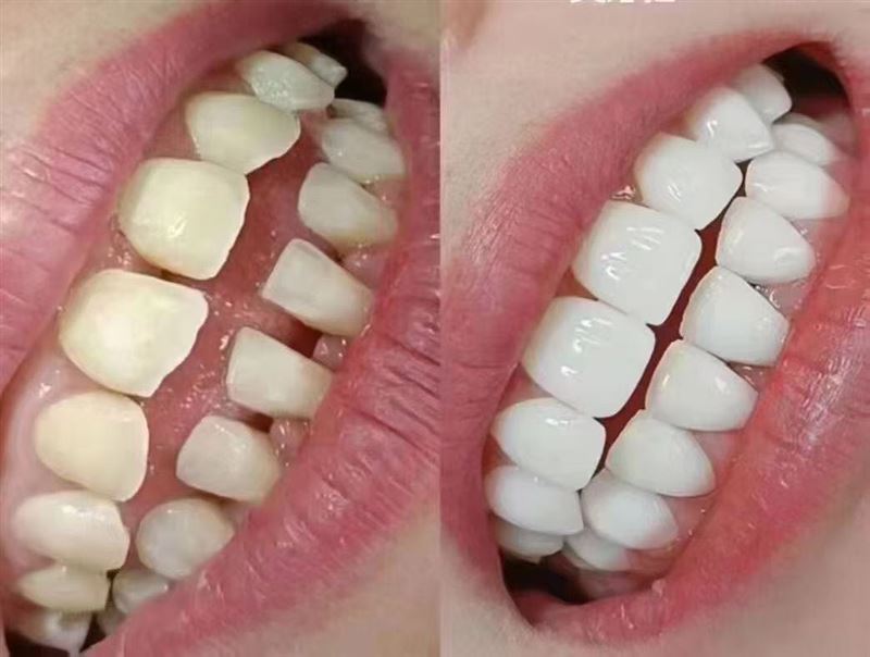 洋洋口腔免费口腔检查招聘大夫护士